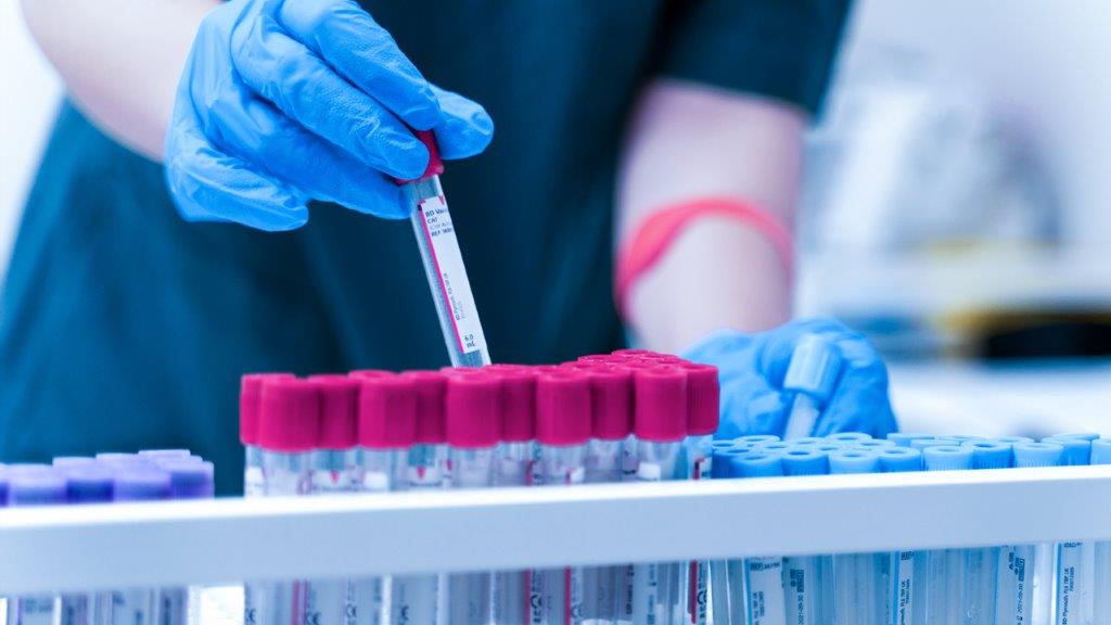 Hematología en Clínica Ortega Huancayo