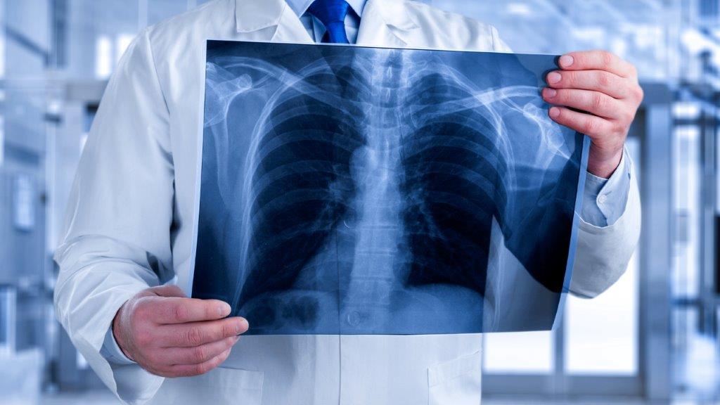 Neumología en Clínica Ortega Huancayo