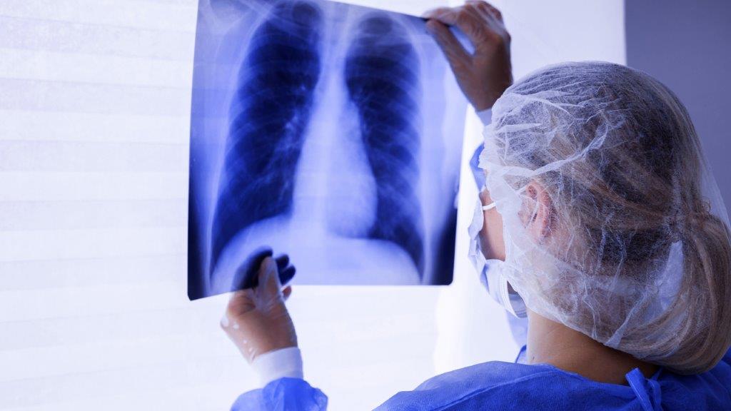 Radiología en Clínica Ortega Huancayo