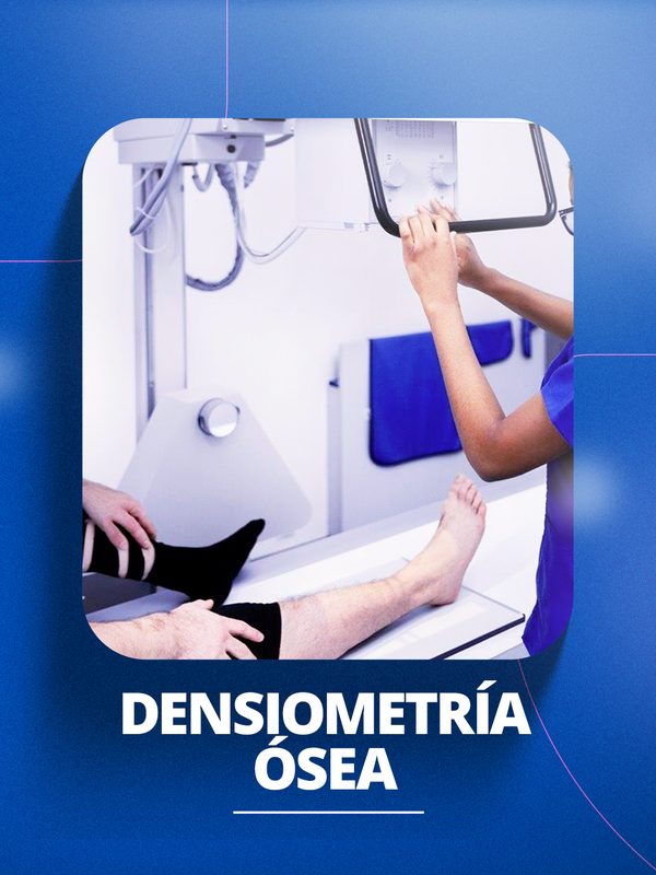 Densiometría Ósea en Huancayo - Clínica Ortega