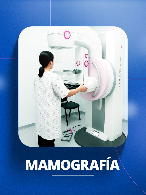 Mamografía en Huancayo - Clínica Ortega