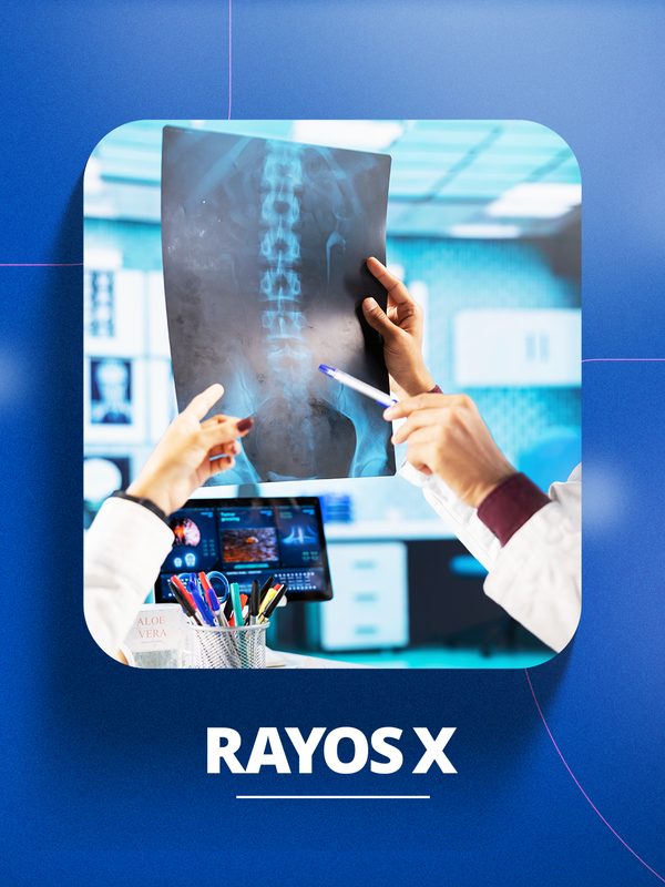 Rayos X en Huancayo - Clínica Ortega